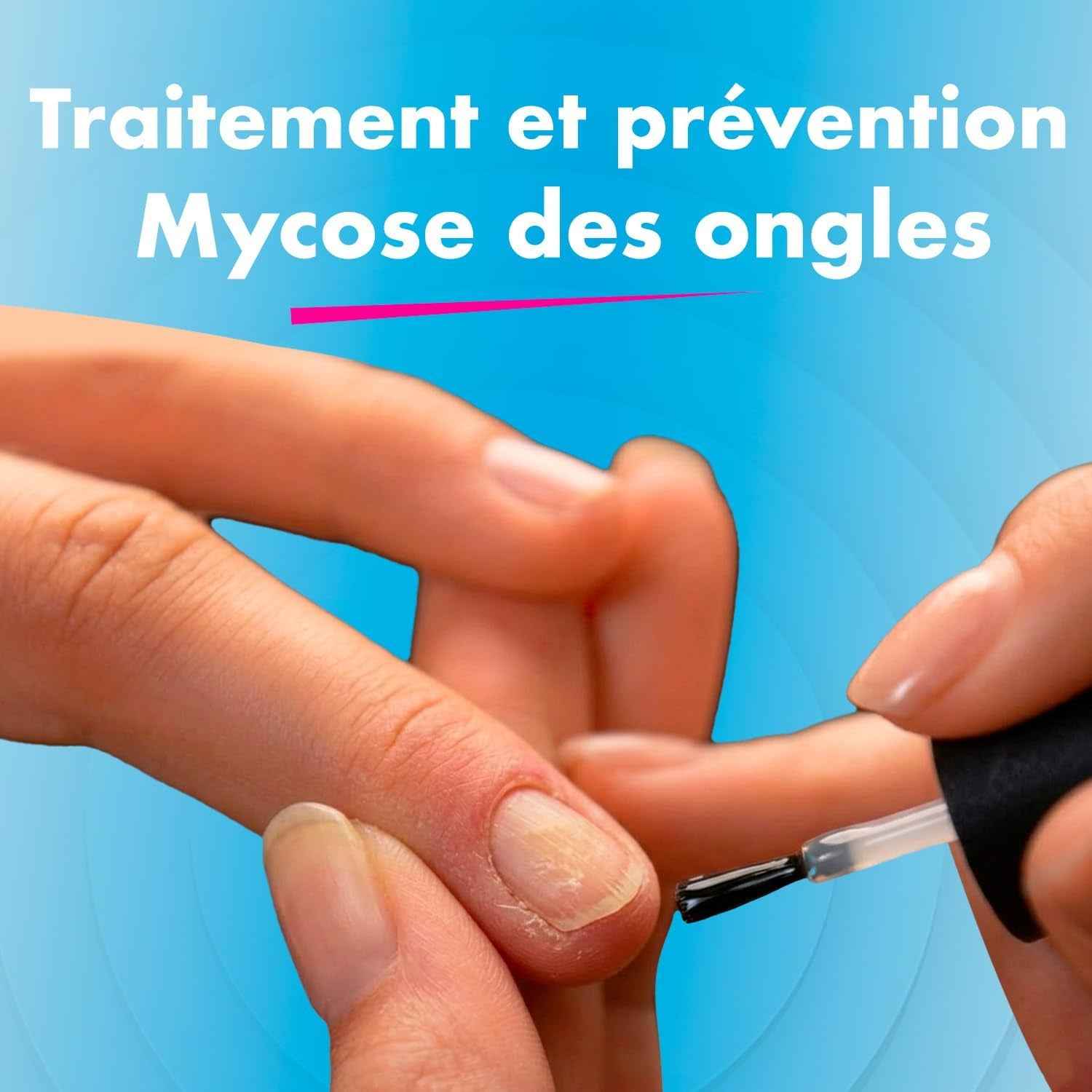 ® Mycose De L’Ongle 3 Actions – Traite La Mycose, Blanchit * Et Renforce Les Ongles * – Application 1 Fois Par Jour – Sans Limage – plus De 400 Applications – 7 Ml